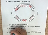 みがき残しの多いところはどこかな？